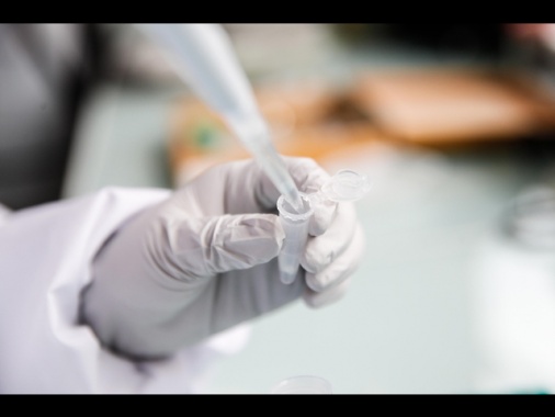 Tumore al seno, nuovi passi avanti contro le forme più gravi