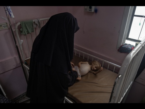 Ministero Salute Gaza, 4 morti per fame in 24 ore, anche 2 bimbi